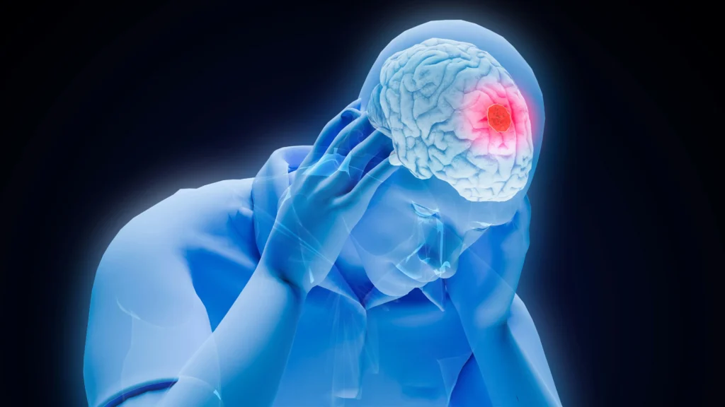 3D medical illustration of a traumatic brain injury highlighting why hiring a Chicago Brain Injury Lawyer is crucial.