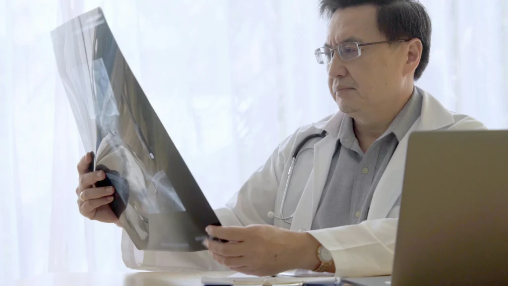 Physician reviewing X-ray results for possible errors needing a delayed diagnosis lawyer