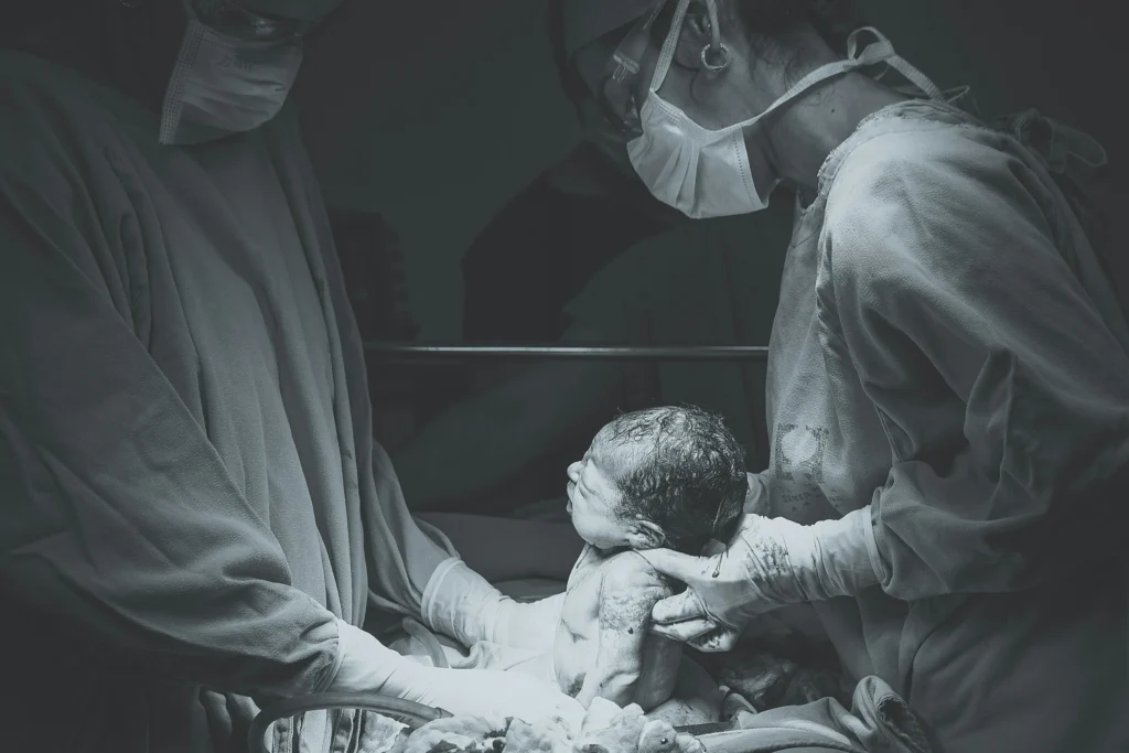 Doctors performing a delivery in operating room, similar to cases reviewed by the best birth injury lawyer.